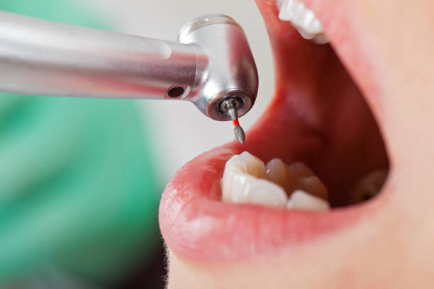 Best Emergency Gum Treatment in Rancho Viejo, TX